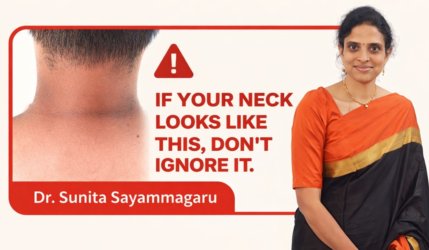 Acanthosis Nigricans, Sunita Sayammagaru, Dark Neck Patches, Insulin Resistance Signs, Early Diabetes Symptoms, Metabolic Disorders, Youth Health Awareness, Preventive Healthcare India, Lifestyle Diseases, Dr Sunita Sayammagaru, Public Health India